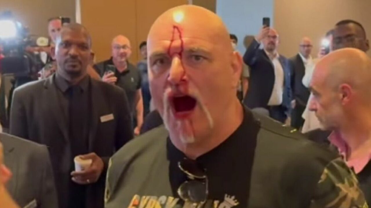 Man Headbutted By John Fury Discusses Shock Incident