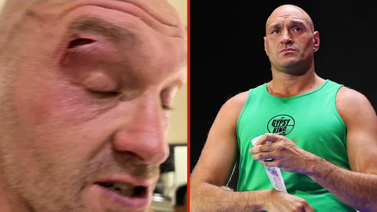 Tyson Fury Manager Blames New Man For Cut – And It Isn’t The Fighter Who Did It